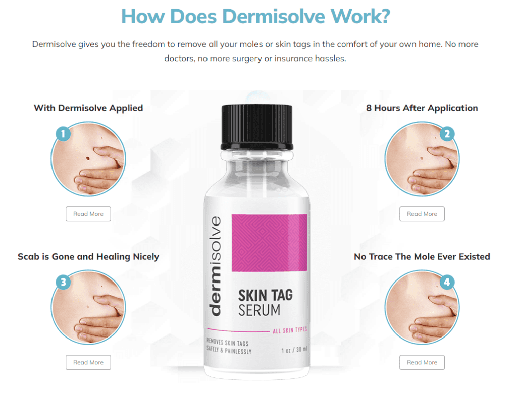 Dermisolve skin Tag Remover